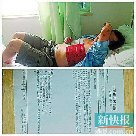 ■张芊发微博称父亲在三亚被保安殴打并晒出其照片。