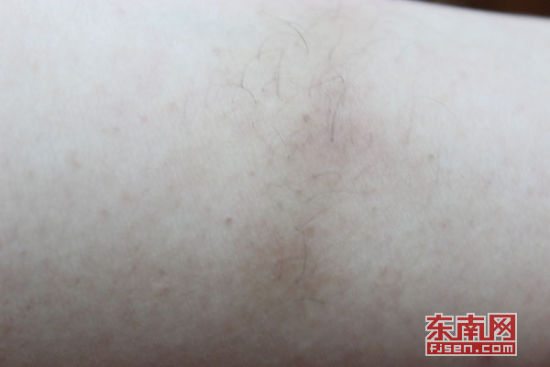 消费者喷用云南白药长出黑毛