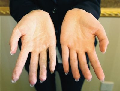 图为实验人员通过手搓法鉴别纯奶油