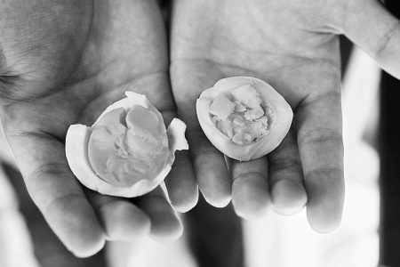 　　和正常蛋黄颜色相比，疑似“假鸡蛋”蛋黄(左)色泽较深。