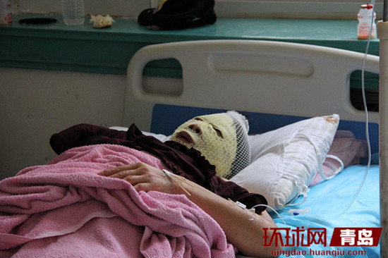 乘客面部受伤严重