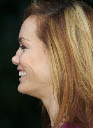 　　伦敦名媛塔拉·帕尔默-汤姆金森的“芋头鼻”是这次调查中最少见的，在1300人种，哈米尔只发现了一人有这样的鼻子，教授看到的不会正是汤姆金森本人吧！