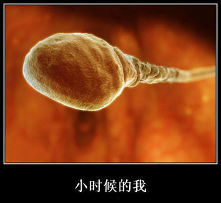 老师交待每人明天要交一张小时候的大头照。选来选去就这张了。