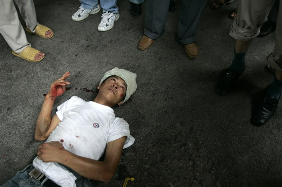 图文:骑摩托车男子被撞伤