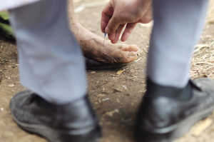 长年的山上生活让老三患上了脚病，医生正在为他诊断病情 