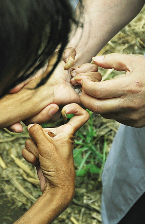  紧扣20余年的双手，变得犹如鸟爪一般，甚至已经丧失了基本的功能 
