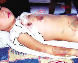 女童"被虐"事件终定论 最毒后妈是最大谣言