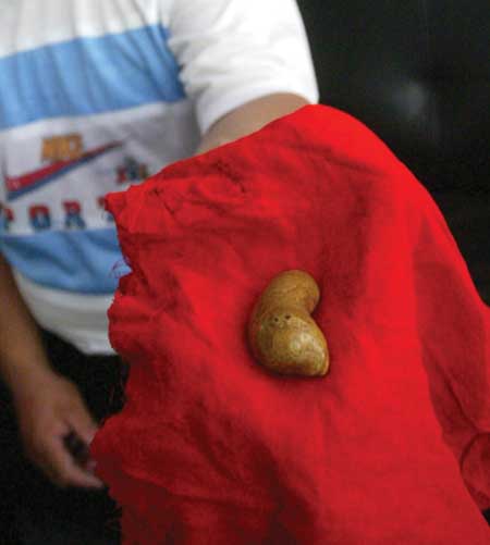 羊胃长块石疑似为羊宝图