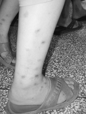 这个梅雨天 "病"得可不轻