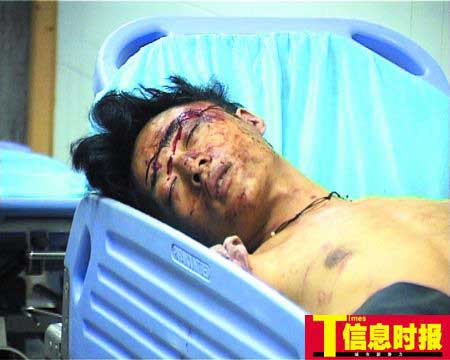 被打的李某称自己不是人贩子.