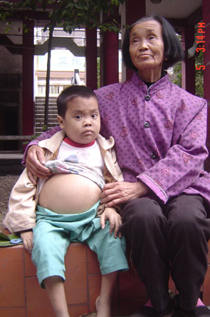 "在她身旁,一名大概八九岁的小男孩,挺着一个大肚子,也抽泣着抹着眼泪