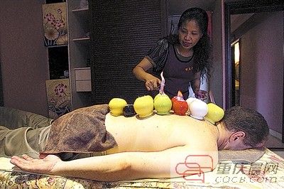 乔·乌尼曼用拔瓷罐的方法减肥。 重庆晨报记者 高科 实习生 曹靖愉 摄
