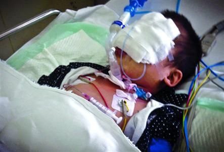 受伤男孩脸上贴着纱布，躺在重症监护室中。/晨报记者　肖允 