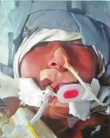 正在治疗中的周通。他家境贫寒，10岁时就已是家里的顶梁柱