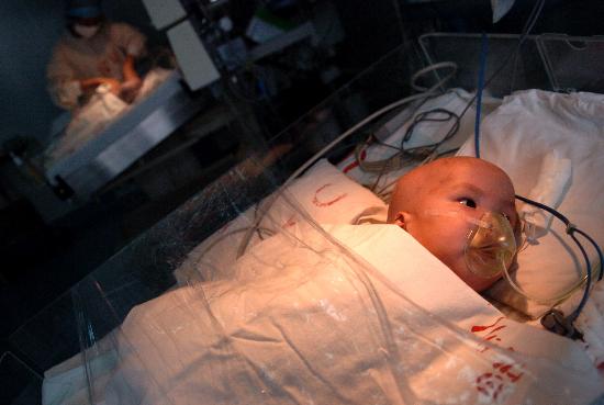 图文:〔社会〕(1)云南成功分离连体婴儿