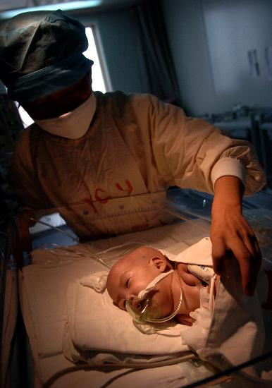 图文:〔社会〕(2)云南成功分离连体婴儿