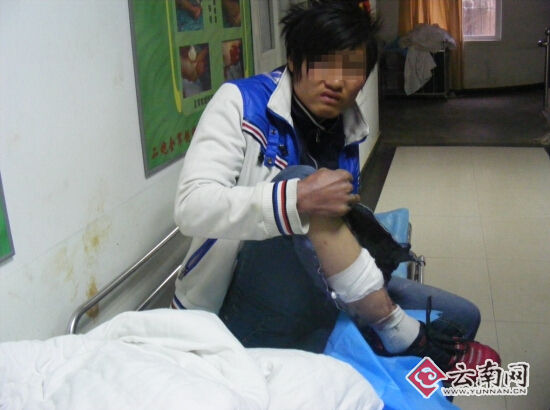 施某某每次碰瓷伤的都是右脚踝，老伤次次都没好。警方供图