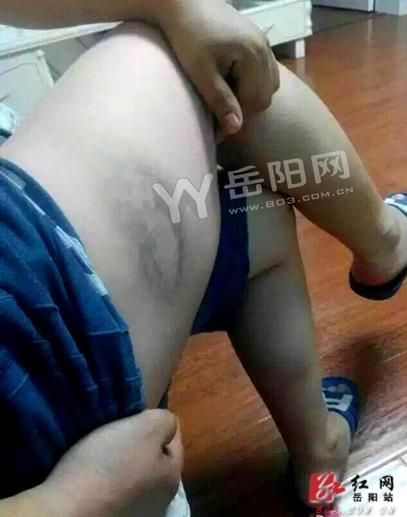 岳阳宝马与公交车“亲吻”，女车主喊人暴打公交司机。 