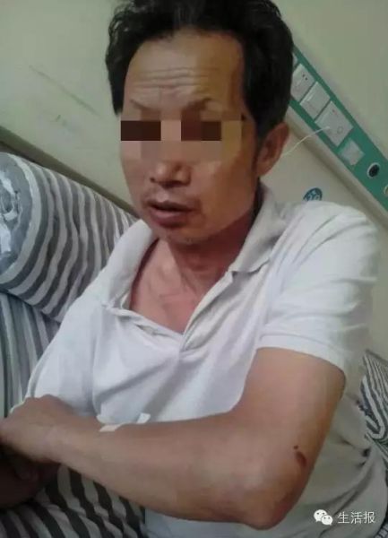 老人被打后