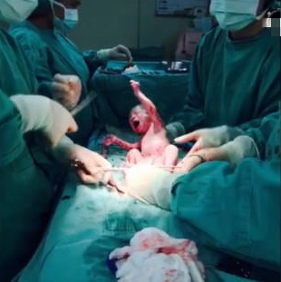 范玮琪儿子产房出生照