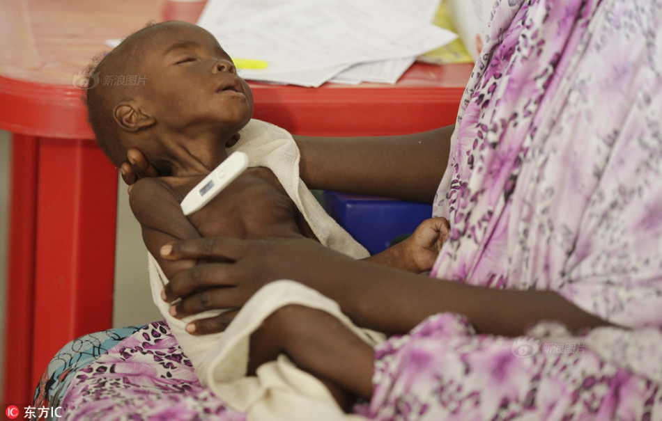 尼日利亚儿童在难民营挨饿 奄奄一息