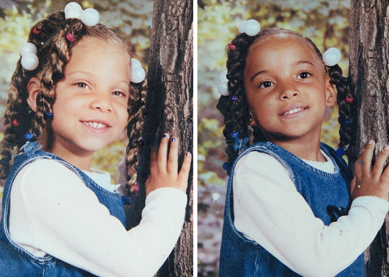 双胞胎姐妹因肤色不同受嘲笑