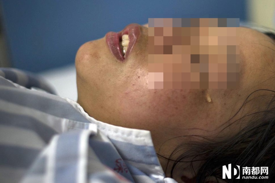 深圳:女子自称拒绝行房被夫砍断手脚筋_高清图集_新浪网