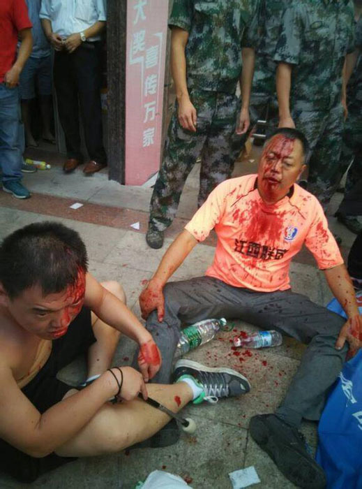 冲甲大战场外爆发激烈冲突 球迷被打得满脸是血
