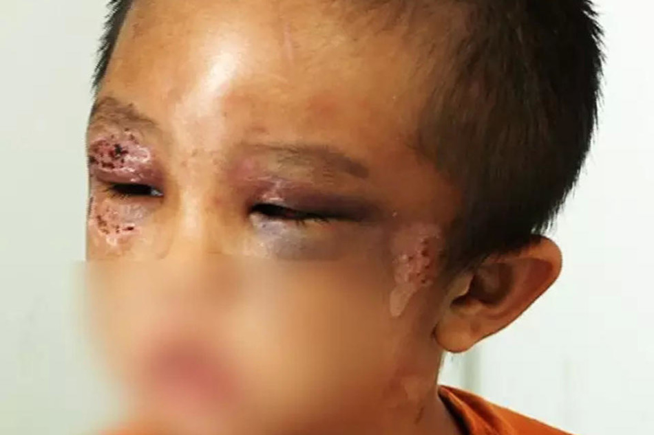 佛山19岁后妈钢管暴打6岁男童