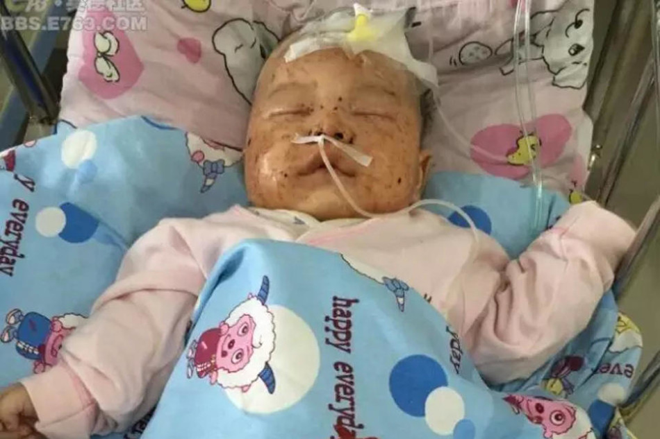 清远草丛现弃婴满脸血迹爬满蚂蚁