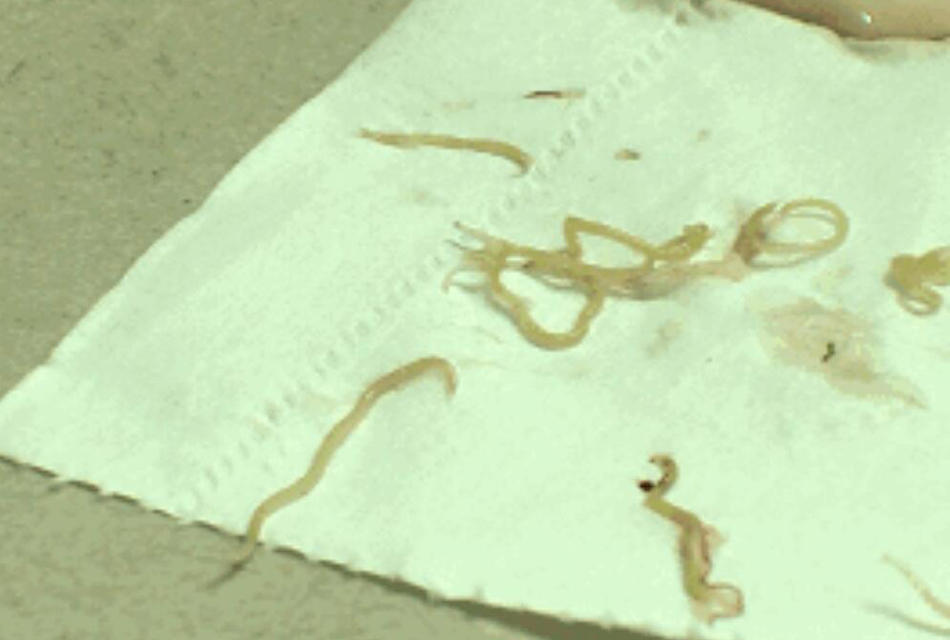 广州一鱼肚中现20条虫 专家称仍可食用