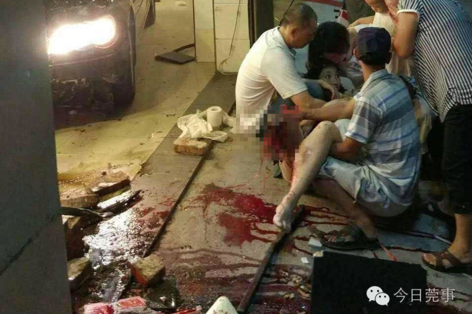 图中女子右腿齐膝而断.
