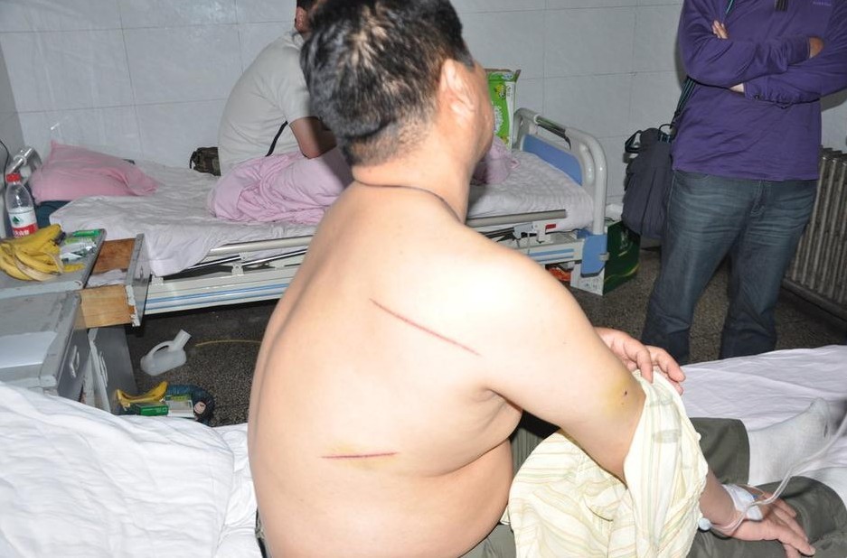 平顶山多名男子当街砍人