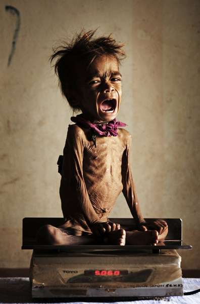 非洲贫困儿童饥饿图片图片