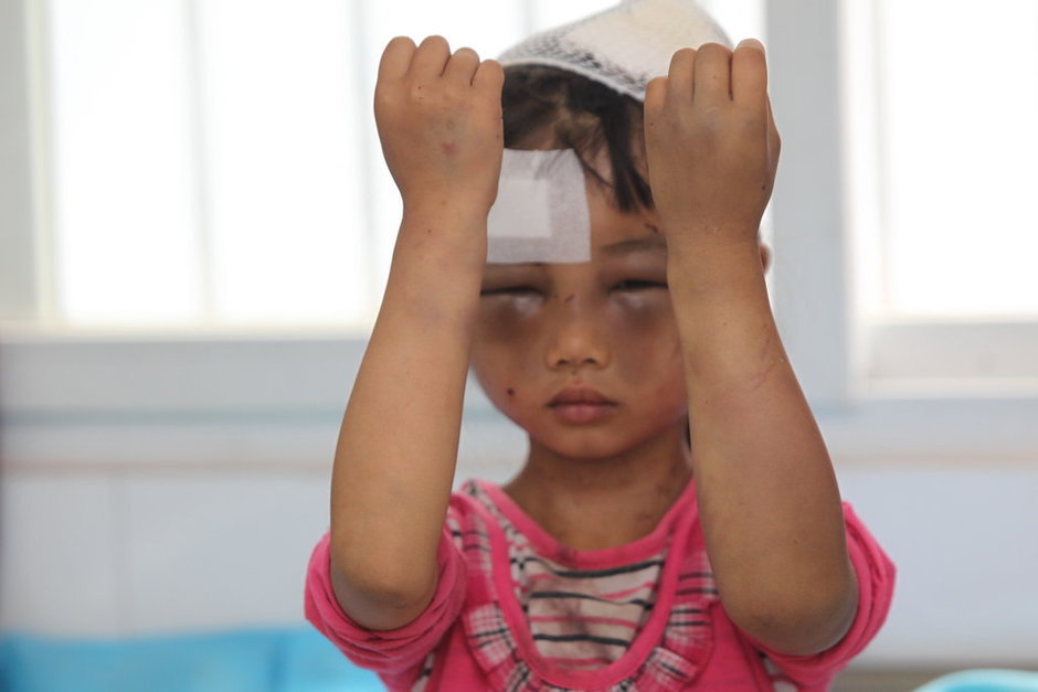 重庆7岁女童因采花被打成重伤