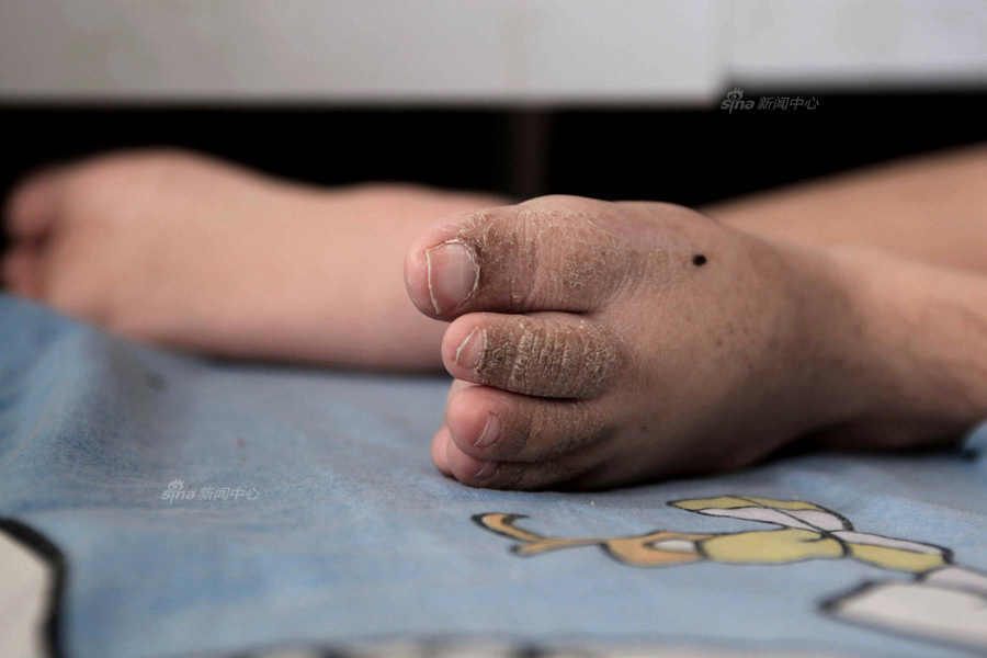 看见147期:玻璃娃娃