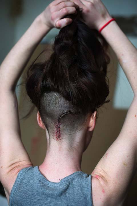 16 加拿大摄影师托尼·福斯花费九个月的时间帮助一个名叫斯蒂芬妮