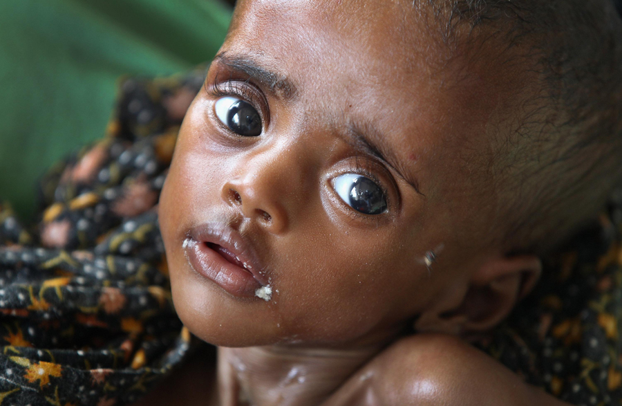 国际消除贫困日:那些渴望的眼神_高清图集_新浪网