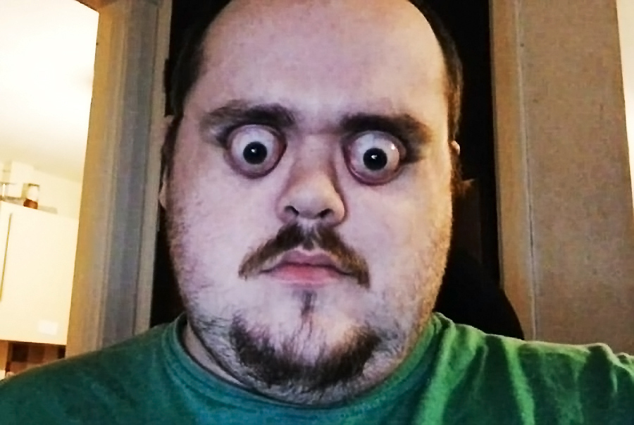 英男子眼睛可瞪出12毫米被称变焦先生