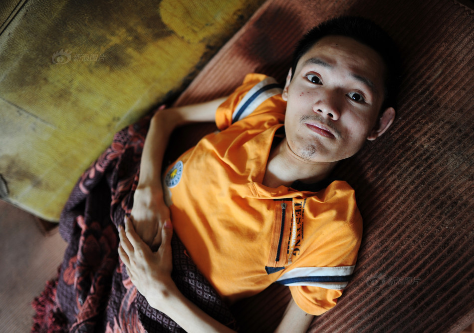 南昌一个家庭两个"渐冻人"