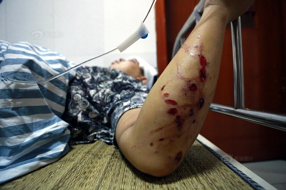 醴陵市浦口镇保丰村的南阳出口花炮厂发生爆炸