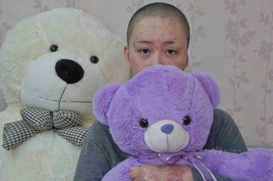 被毁容少女索赔360余万