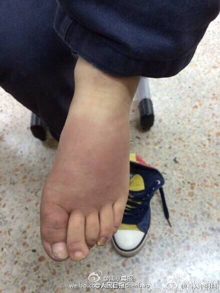 南京被打男童被生父送回学校