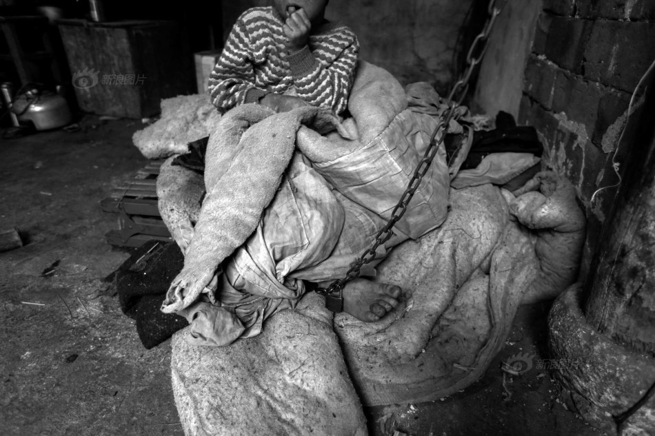 被囚禁的精神病人