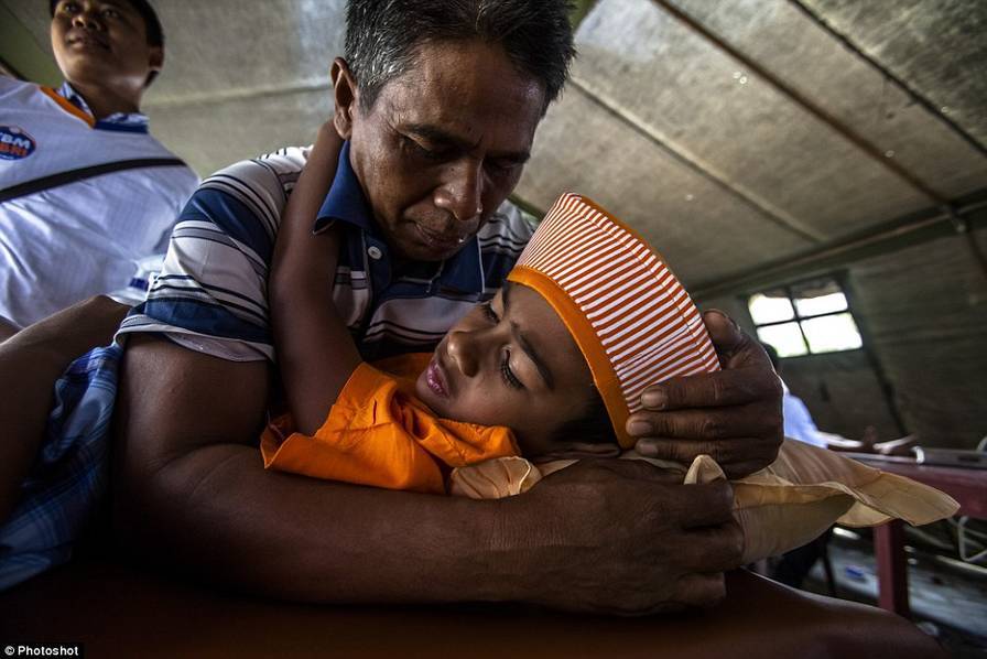 印尼男孩集体割礼现场