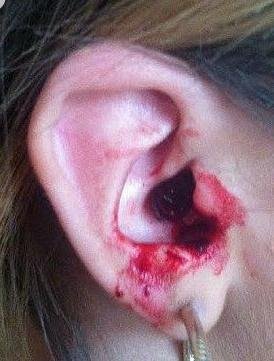 英国少女患神秘怪病 每天五孔流血半小时