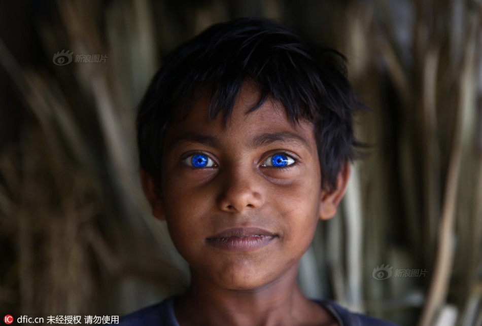 孟加拉少年奇异蓝眼睛散发魅力光芒