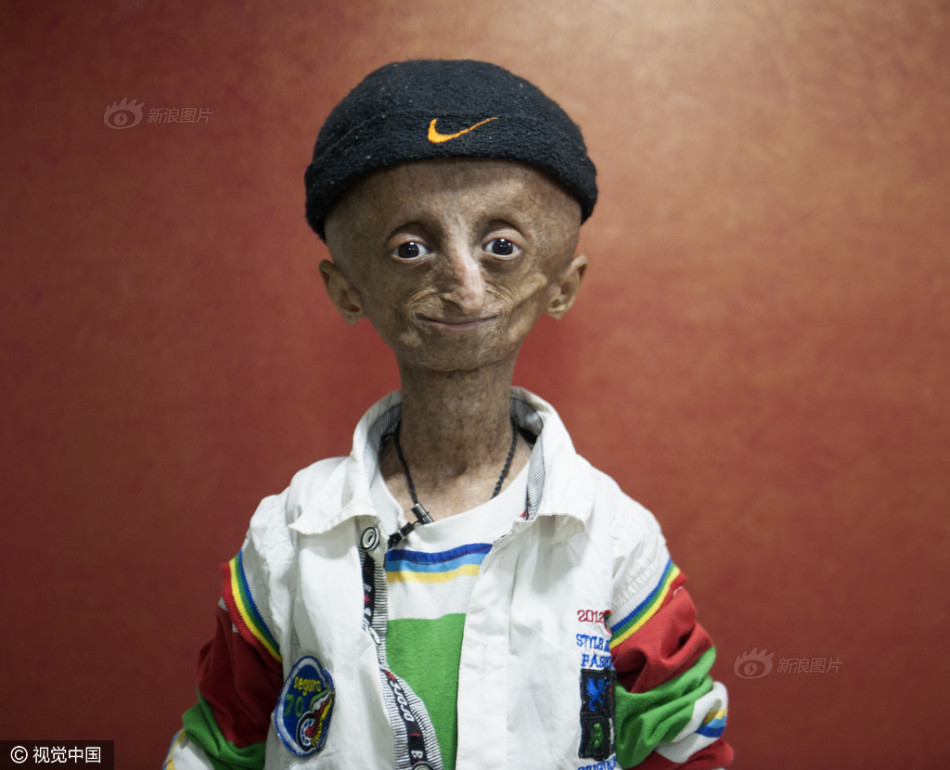 1 / 8 尼哈尔·比塔拉(nihal bitla)资料图.