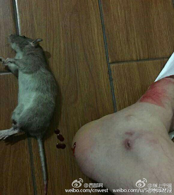 陕西汉中一宾馆发生老鼠咬人事件