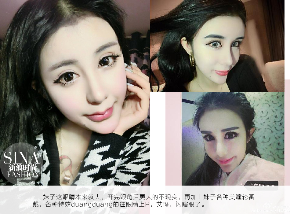 审美观崩塌 15岁萌妹整容成二次元蛇精